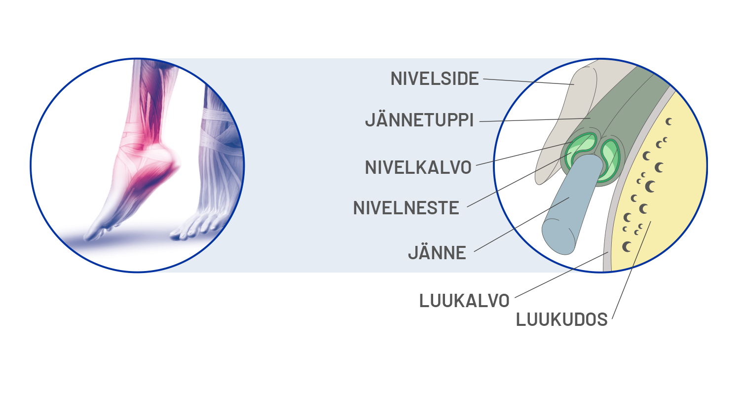 cetilar_janteet